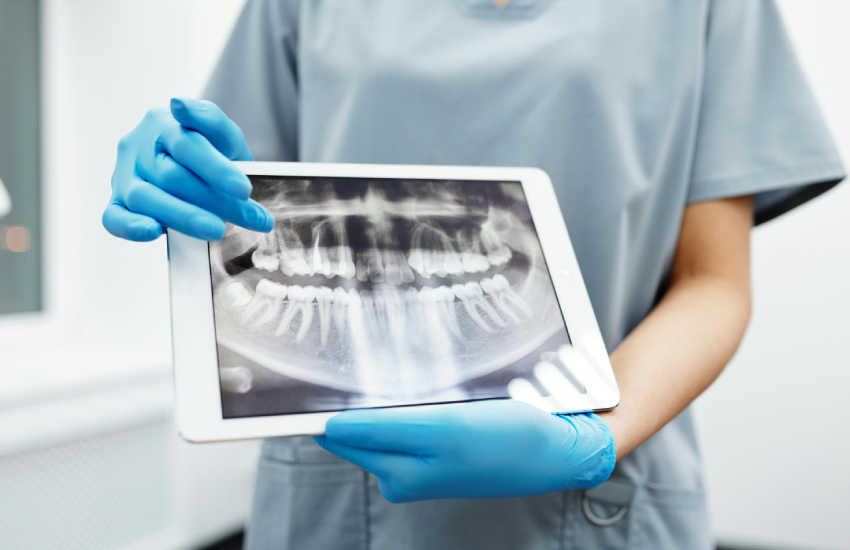 How Long Do Root Canals Take? A Comprehensive Guide